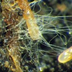 hyphae among the plant root hairs